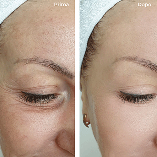 Anti-aging eye and lip contour fluid - Hyaluronic Acid - Image 4
