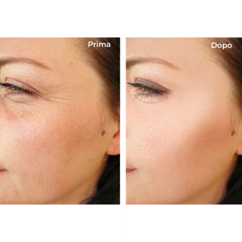 Anti-aging face cream - Hyaluronic Acid - Image 4