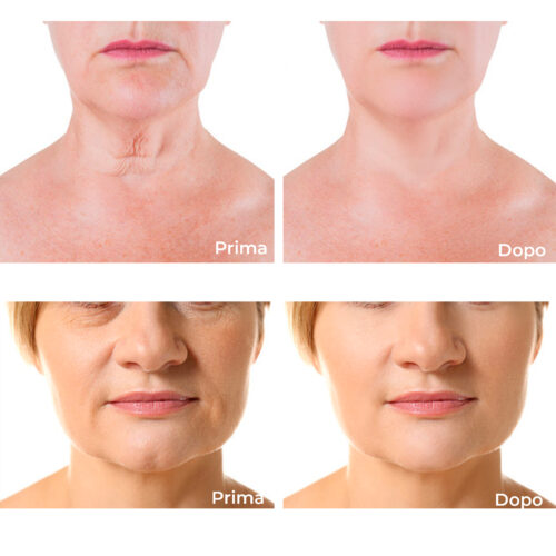 Concentrated lifting effect serum - Hyaluronic acid - Image 4